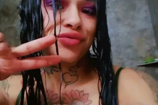 hit me up serious injuries only - Image 5