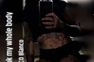 hit me up serious injuries only - Image 6