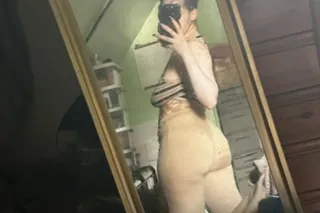 INCALLS🤎🤍🤎🤍🤎🤍🤎vitiligo babe in... - Image 3