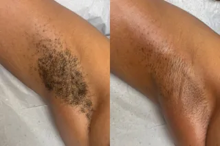 have you ever thought about ge... - Image 3