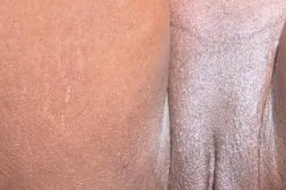 100 incall special - 24 - Image 3