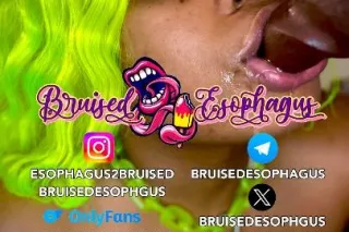 🫠ⓂⒶⓀⒺ I̸T̸ N̸A̸S̸T̸Y̸👅💦❤𝕻𝖗𝖔𝖘𝖙𝖆𝖙𝖊🕳🪠𝕻𝖑𝖚𝖒𝖇𝖊𝖗 👀🎬 🌽 №➊ choice🏆✔Videos & FaceTime Fun 📲💦⭐🅕🅡🅔🅐🅚 Of The 🅦🅔🅔🅚 😈💦💋 - Image 9