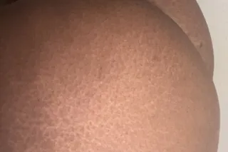 Young Tight Pussy 💦🍑🫦 - 25 - Image 1