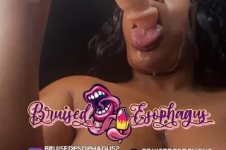 🫠ⓂⒶⓀⒺ I̸T̸ N̸A̸S̸T̸Y̸👅💦❤𝕻𝖗𝖔𝖘𝖙𝖆𝖙𝖊🕳🪠𝕻𝖑𝖚𝖒𝖇𝖊𝖗 👀🎬 🌽 №➊ choice🏆✔Videos & FaceTime Fun 📲💦⭐🅕🅡🅔🅐🅚 Of The 🅦🅔🅔🅚 😈💦💋 - Image 8