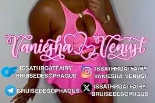 💲тσρ🚫✋🏾•👀🅱eiᑎg 🧨✨•ᵀᴱᴹᴾᵀᴱᴹᵀᴱᴰ🔥&⭐🐒🅲🅾🅼🅴 • 🇬 🇪 🇹• 🤤ᗩᗪᗪᎥᑕ丅ᗴᗪ‼•👅 🏆 - Image 9