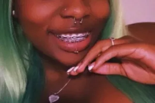 GREEN HAIRED BRACE FACE BABY 😍... - Image 2