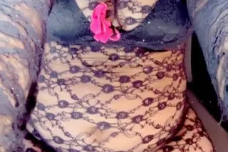 $120 oral specials only 🥰 🔥EXO... - Image 3