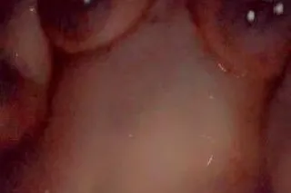 💋 itty Bitty - 25 - Image 2